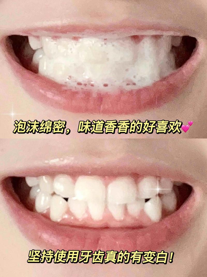 怎样使牙齿变白